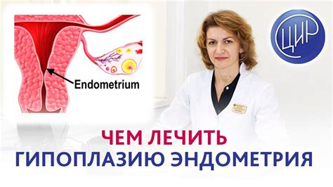 Гипоплазия эндометрия