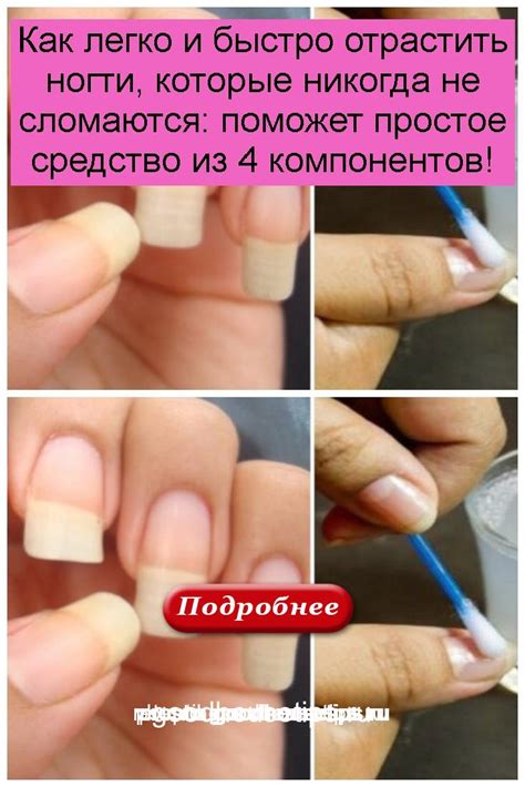 Как быстро отрастить ногти