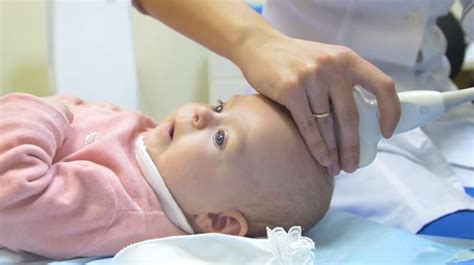 Узи головного мозга у новорожденных